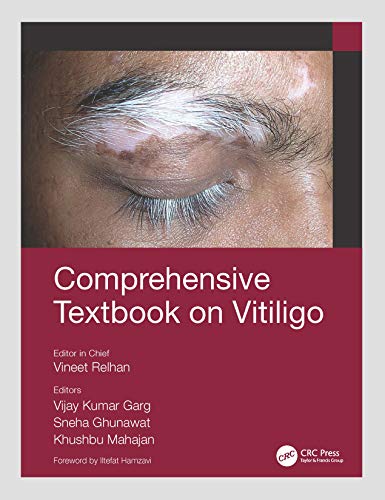 Beispielbild fr Comprehensive Textbook on Vitiligo zum Verkauf von Blackwell's