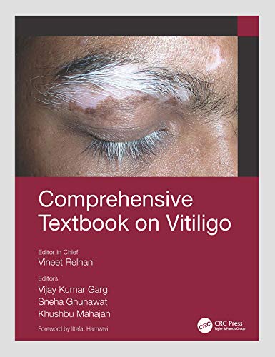 Stock image for Comprehensive Textbook on Vitiligo for sale by Books Puddle
