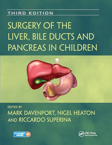 Stock image for Surgery of the Liver, Bile Ducts and Pancreas in Children for sale by Basi6 International