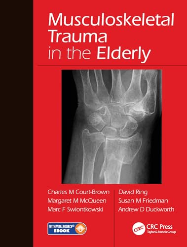 Imagen de archivo de Musculoskeletal Trauma in the Elderly a la venta por Revaluation Books
