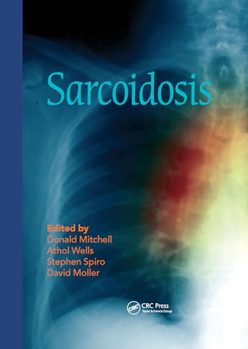Stock image for Sarcoidosis for sale by Blackwell's