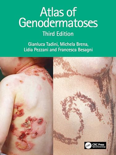 Immagine dell'editore per Atlas of Genodermatoses venduto da Books Puddle