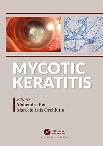 Stock image for Mycotic Keratitis for sale by Blackwell's