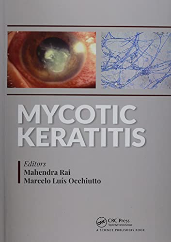 9780367779382: Mycotic Keratitis