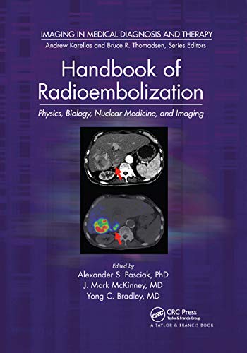 Imagen de archivo de Handbook of Radioembolization a la venta por Blackwell's