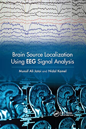 Stock image for Brain Source Localization Using EEG Signal Analysis for sale by Blackwell's