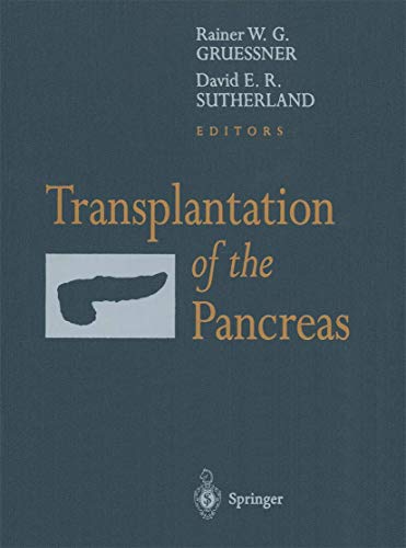 Stock image for Transplantation of the Pancreas for sale by medimops