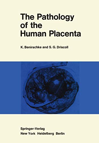 The Pathology of the Human Placenta (9780387037356) by Kurt Benirschke