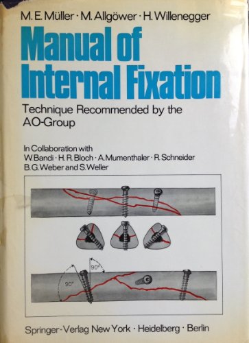 9780387052199: Manual of internal fixation;: Technique recommended by the AO-Group,