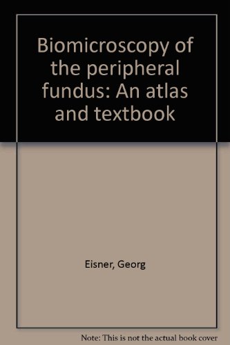 9780387063744: Biomicroscopy of the peripheral fundus: An atlas and textbook