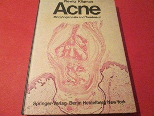 Stock image for Acne: Morphogenesis and Treatment for sale by George Kent, Bookseller