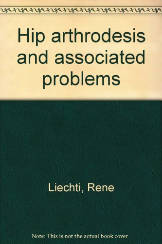 Hip arthrodesis and associated problems (9780387086149) by Liechti, ReneÌ