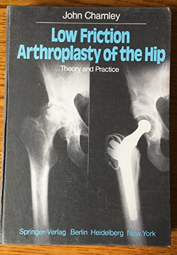 Imagen de archivo de Low Friction Arthroplasty of the Hip: Theory and Practice a la venta por ThriftBooks-Atlanta