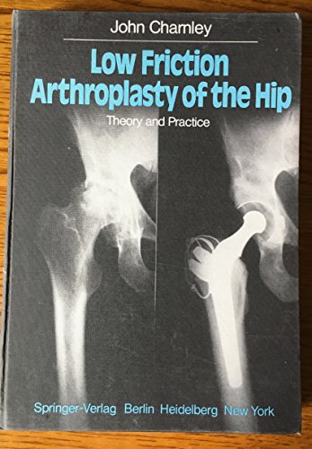 Stock image for Low Friction Arthroplasty of the Hip: Theory and Practice for sale by ThriftBooks-Atlanta