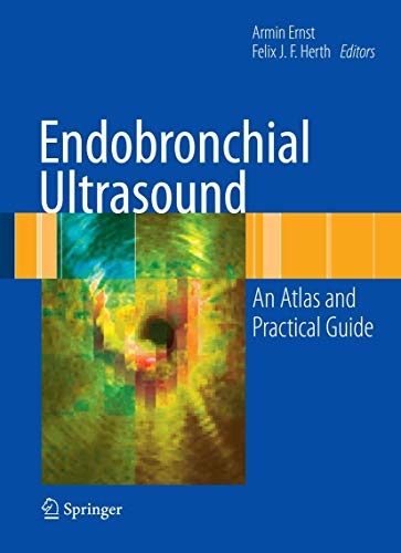 9780387094366: Endobronchial Ultrasound: An Atlas and Practical Guide