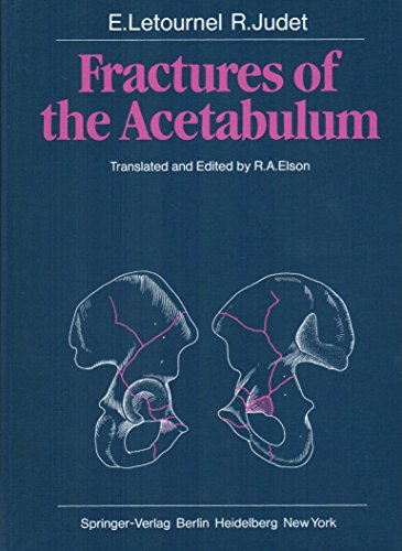 9780387098753: Fractures of the acetabulum [Hardcover] by Emile Letournel