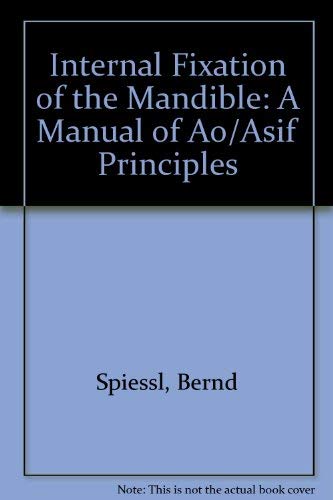 cabin Min Clip butterfly 9780387162829: Internal Fixation of the Mandible: A Manual of Ao/Asif  Principles (English and German Edition) - Spiessl, Bernd: 0387162828 -  AbeBooks