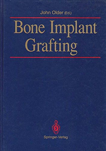 Bone Implant Grafting