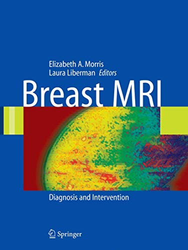 Stock image for Breast MRI: Diagnosis And Intervention for sale by Revaluation Books