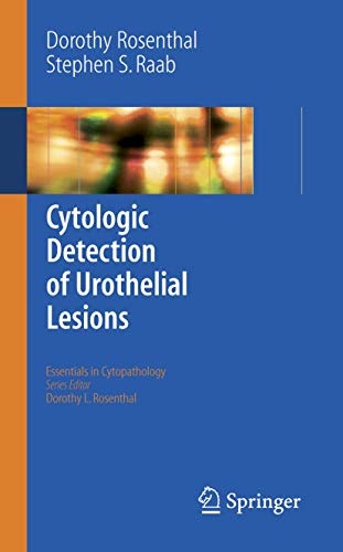 Imagen de archivo de Cytologic Detection of Urothelial Lesions (Essentials in Cytopathology, 2) a la venta por HPB-Red