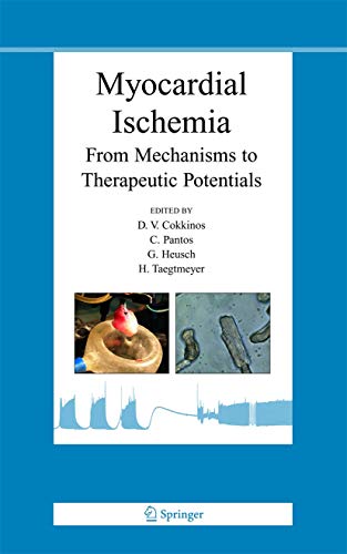 Beispielbild fr Myocardial Ischemia: From Mechanisms to Therapeutic Potentials (Basic Science for the Cardiologist, 21) zum Verkauf von BooksRun