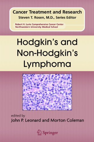 Hodgkin*s And Non-hodgkin*s Lymphoma (cancer Treatment And Research)