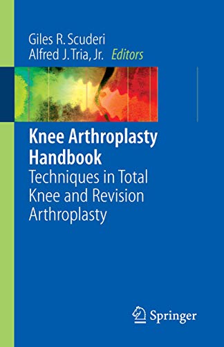 Stock image for Knee Arthroplasty Handbook: Techniques In Total Knee And Revision Arthroplasty for sale by Basi6 International