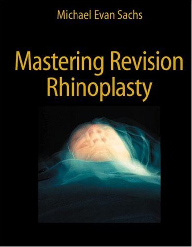 9780387308401: Mastering Revision Rhinoplasty