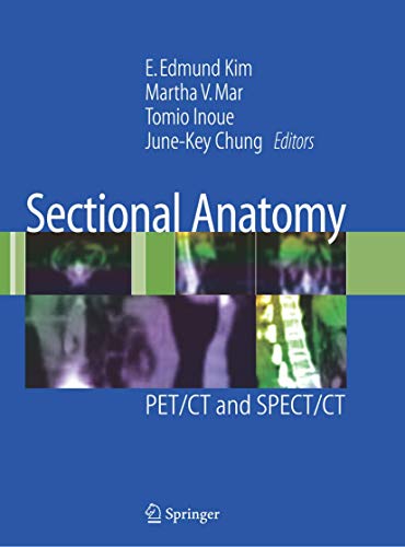 Stock image for Sectional Anatomy: PET/CT and SPECT/CT for sale by ThriftBooks-Atlanta