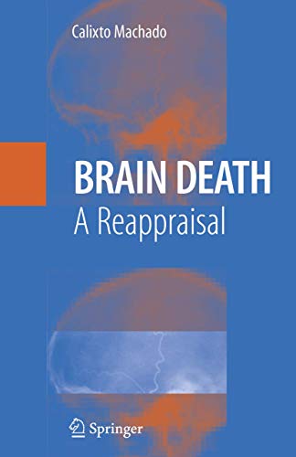 Brain Death: A Reappraisal
                                            onerror=