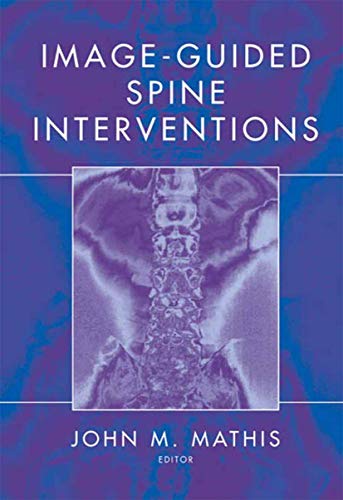 Stock image for IMAGE-GUIDED SPINE INTERVENTIONS for sale by BennettBooksLtd