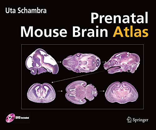 9780387470894: Prenatal Mouse Brain Atlas: Color images and annotated diagrams of: Gestational Days 12, 14, 16 and 18 Sagittal, coronal and horizontal section