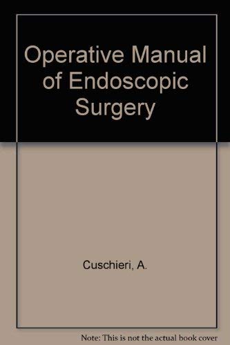 Operative Manual of Endoscopic Surgery