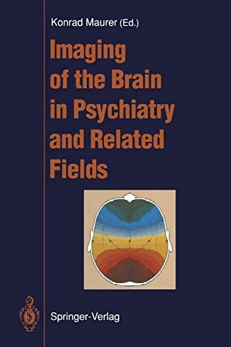 9780387547855: Imaging of the Brain in Psychiatry and Related Fields