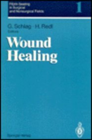 9780387575117: Wound Healing