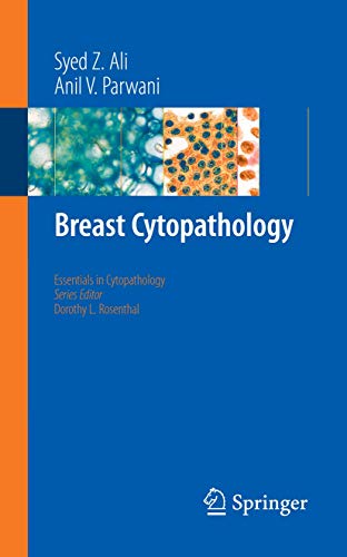 9780387715940: Breast Cytopathology: 4 (Essentials in Cytopathology)