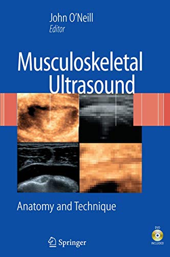 9780387766096: Musculoskeletal Ultrasound: Anatomy and Technique