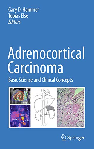 Stock image for Adrenocortical Carcinoma for sale by Basi6 International