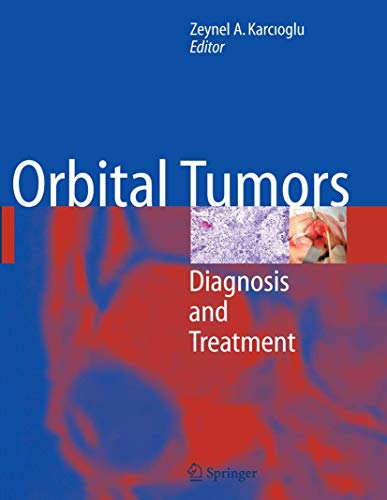 9780387880327: Orbital Tumors: Diagnosis and Treatment