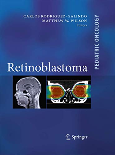 9780387890715: Retinoblastoma (Pediatric Oncology)