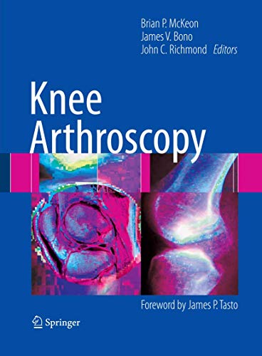 9780387895031: Knee Arthroscopy