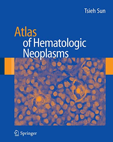 9780387898476: Atlas of Hematologic Neoplasms
