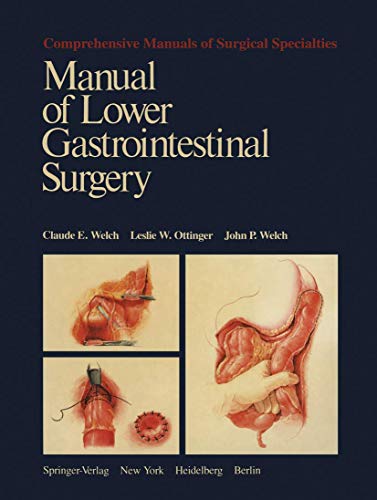 9780387902050: Manual of Lower Gastrointestinal Surgery