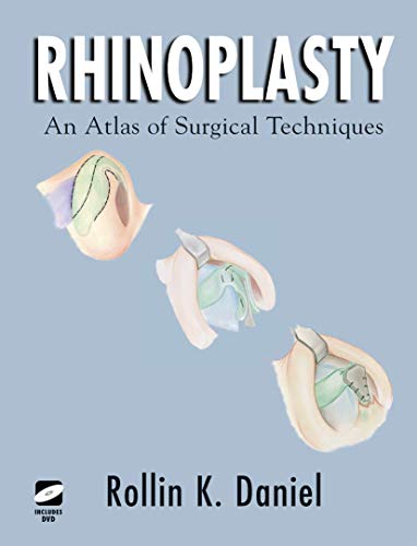 Beispielbild fr Rhinoplasty: An Atlas of Surgical Techniques zum Verkauf von Mispah books