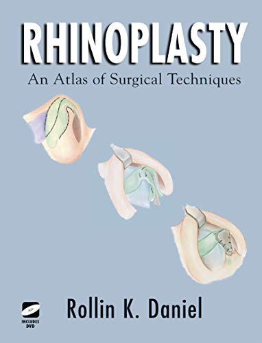 9780387944586: Rhinoplasty : An Atlas of Surgical Techniques