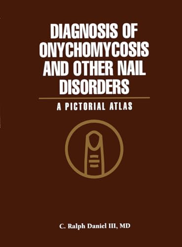 Stock image for Diagnosis of Onychomycosis and Other Nail Disorders: A Pictorial Atlas for sale by SecondSale