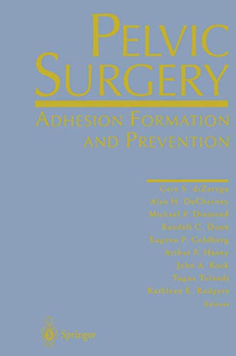 Stock image for Pelvic Surgery: Adhesion Formation and Prevention DiZerega, Gere S.; DeCherney, Alan H.; Diamond, Michael P.; Dunn, Randall C.; Goldberg, Eugene P.; Haney, Arthur F.; Rock, John A.; Tulandi, Togus and Rodgers, Kathleen E. for sale by Aragon Books Canada