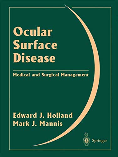 Beispielbild fr Ocular Surface Disease. Medical and Surgical Management. zum Verkauf von CSG Onlinebuch GMBH