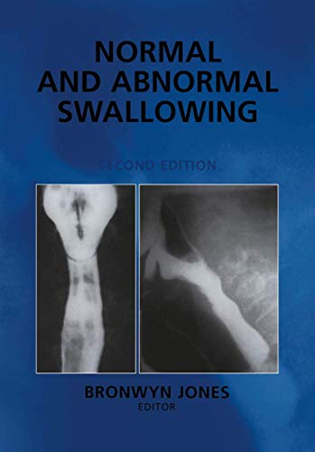 Normal And Abnormal Swallowing