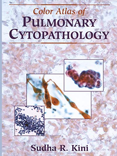 Imagen de archivo de Color Atlas Of Pulmonary Cytopathology a la venta por Romtrade Corp.